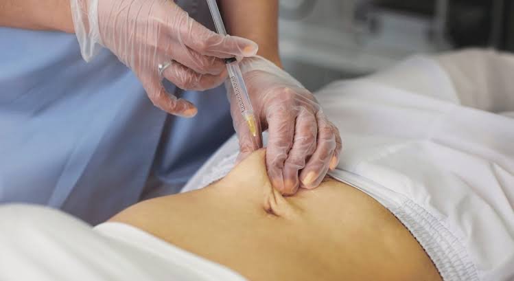 Fat Dissolving Injections