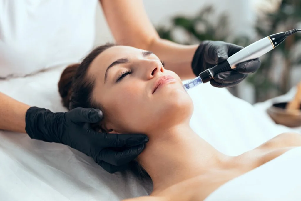 View microneedling