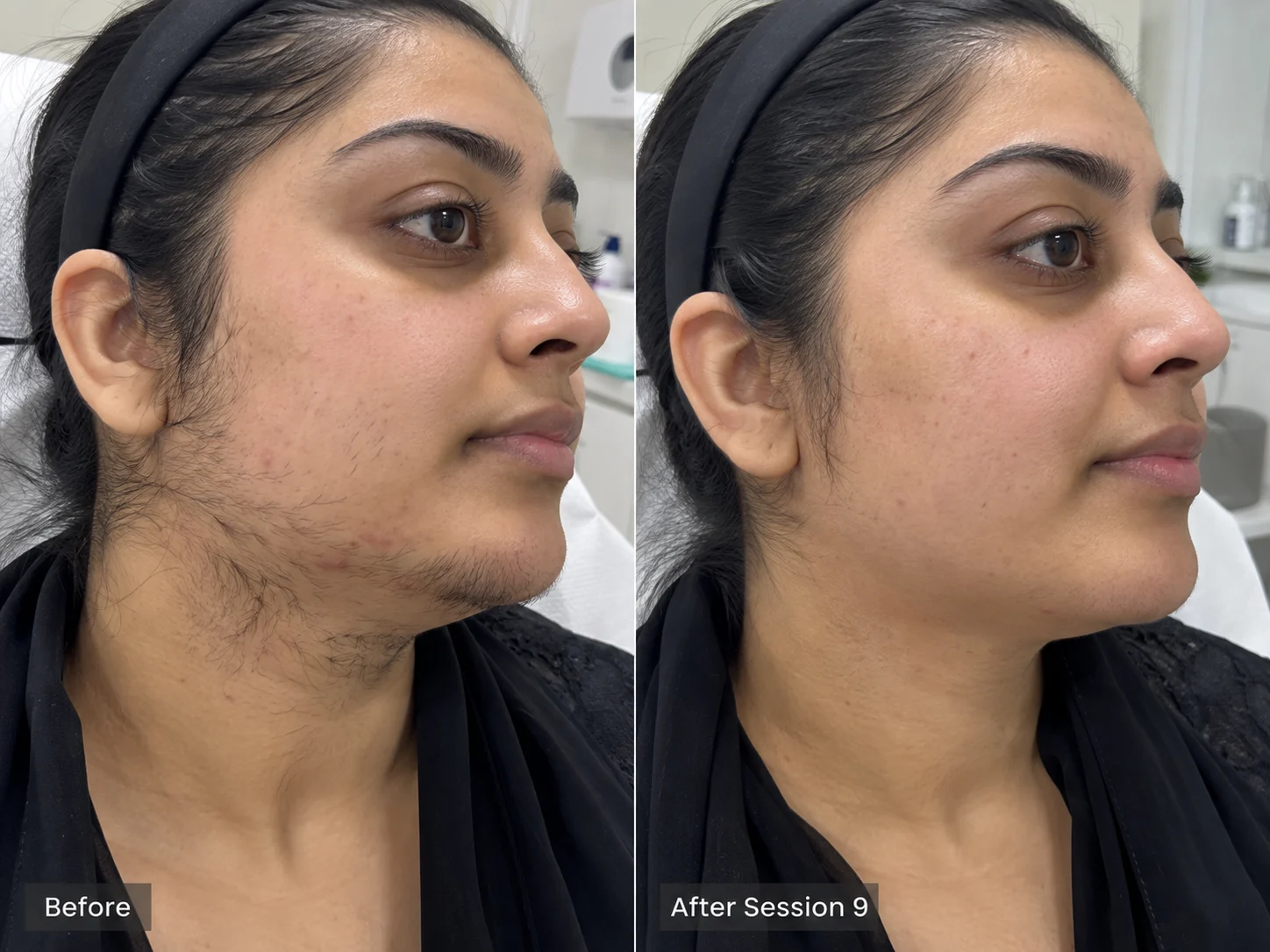 Pakistani Skin
