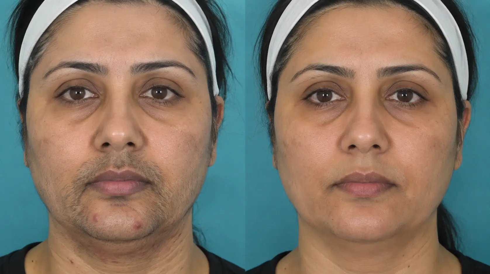 Zainab Full Body Sparkbrook