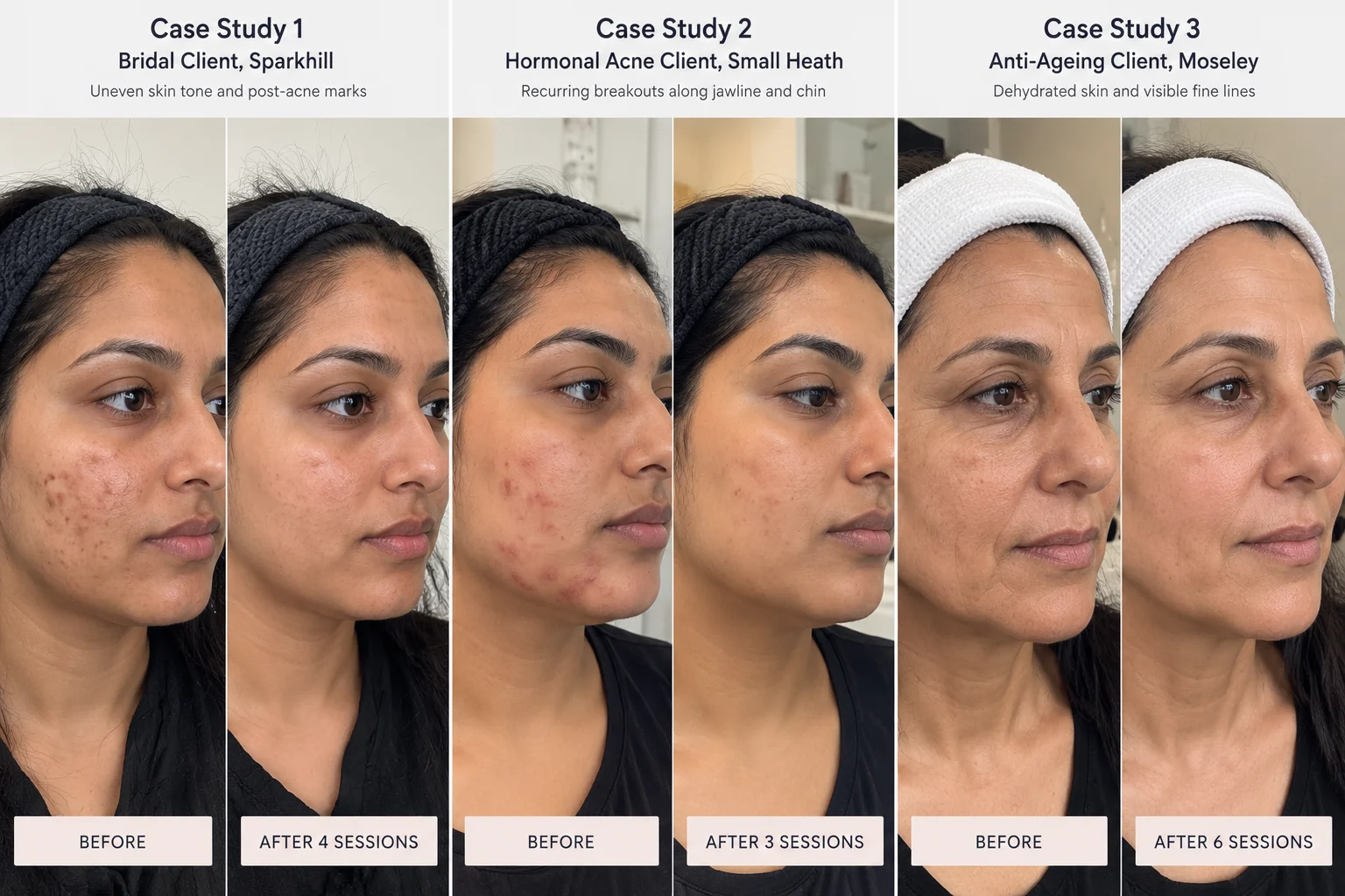 Case Study 3 Anti-Ageing 